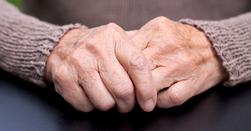 Woman holding fingers in pain due to inflammatory arthritis.