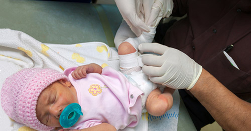 A baby with clubfoot undergoing casting treatment.