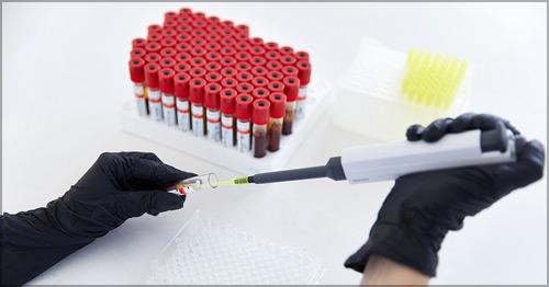 A lab technician extracting a blood sample from a test tube.