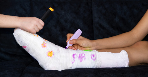 Children writing on a child's cast for a broken leg.