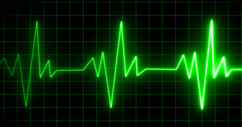 EKG rendering.