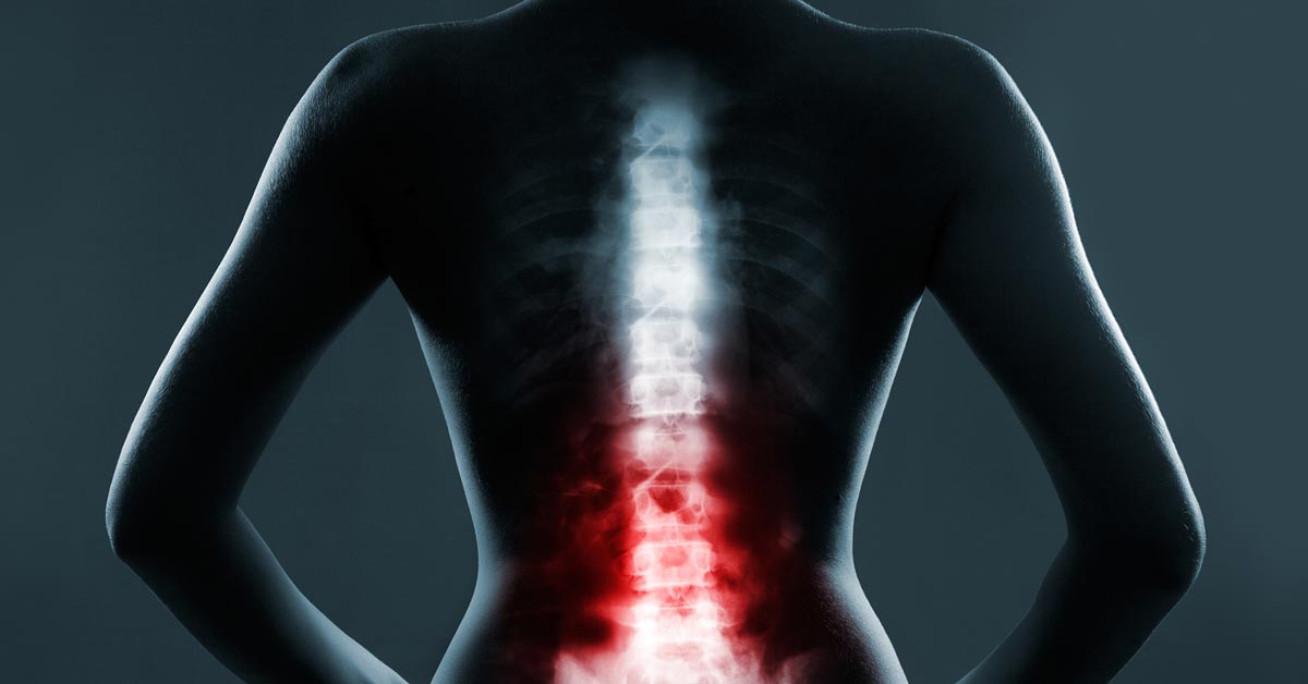 https://www.hss.edu/images/socialmedia/lumbar-spine-pain-1200X628.jpg