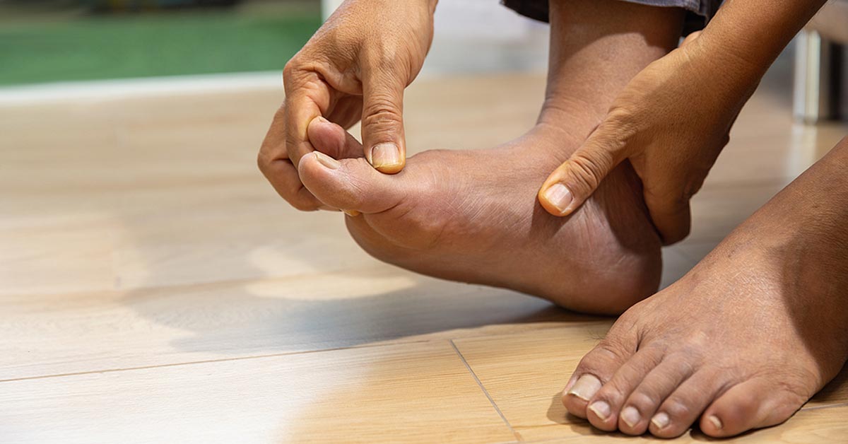 Gout Uric Acid Buildup and Arthritis HSS Rheumatology