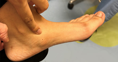 A person pointing to the inside of their midfoot.
