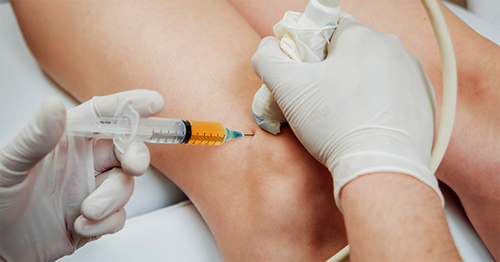 Clinician giving an ultrasound-guided PRP injection in a patient's knee.