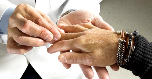 A doctor examining hands of a patient with scleroderma.