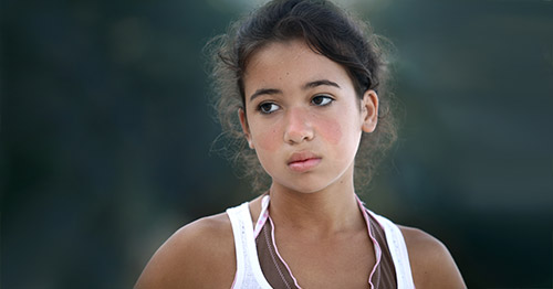 A teenage girl with mild malar rash.