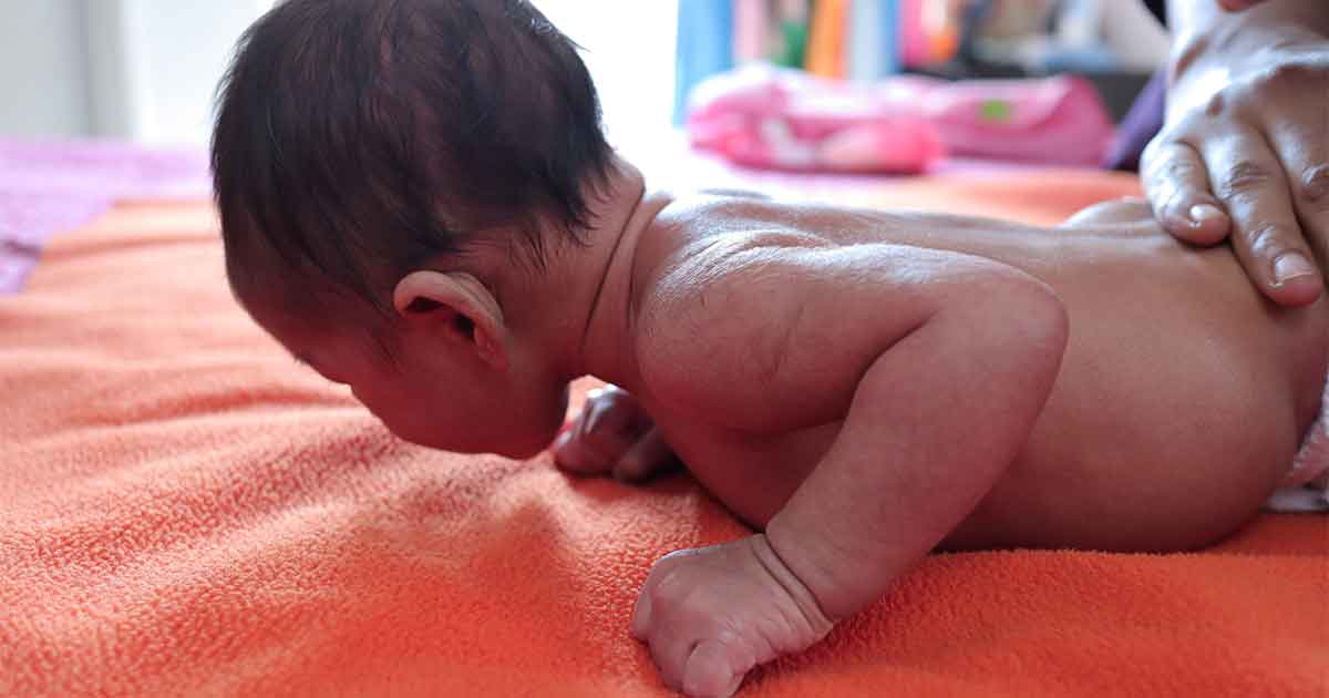 Does Baby's Head Tilt to One Side? It May Be Torticollis